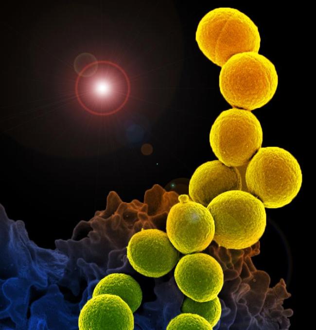 Spheroid Staphylococcus aureus bacteria in a chain-like configuration. 
