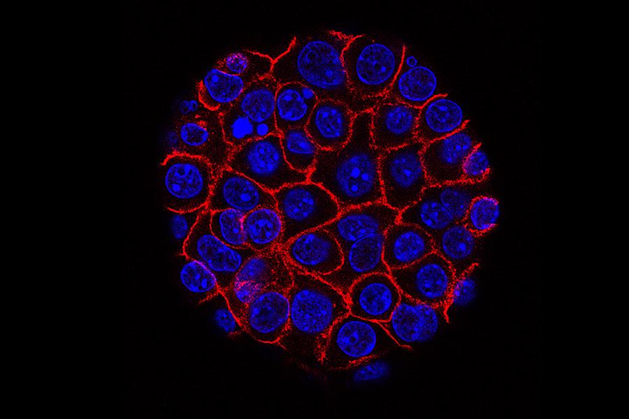 Pancreatic Cancer Cells