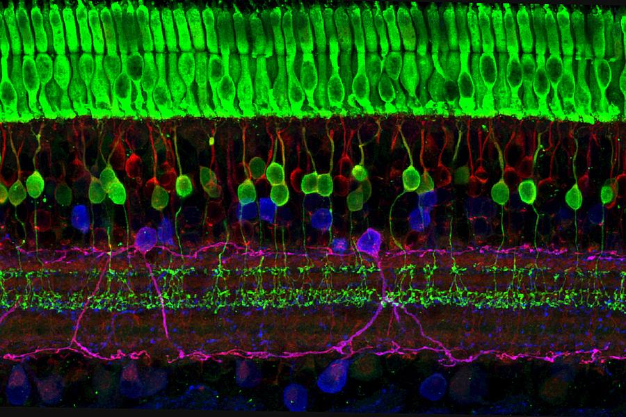 Image capturing the layers of nerve cells in the retina. The top layer (green) is made up of cells called photoreceptors that convert light into electrical signals to relay to the brain.