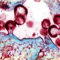 HIV virions budding and releasing from an infected cell.