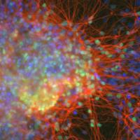  NIH Image Gallery National Institutes of Health (NIH)  Follow Cortical neurons derived from iPS cells.
