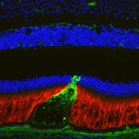 Colorful detailed scanning image of green cone of pseudodrusen poking through the retina.